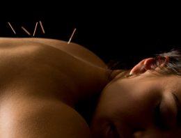 Health Benefits of Acupuncture