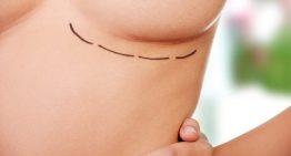 How to Reduce Your Risk of Bottoming Out after Breast Augmentation