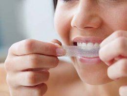 Benefits of Teeth Whitening Strips