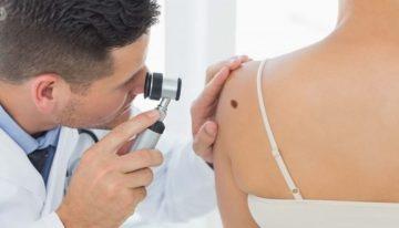 What is Skin Cancer? – Its Type and Various Other Factors