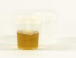 Top Synthetic Urine on the Market
