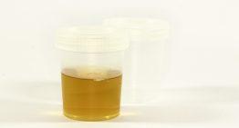Top Synthetic Urine on the Market