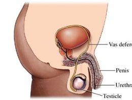 Vasectomy Procedure And Important Info