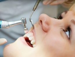 Good Ideas You Can Use to Find a Caring Dentist