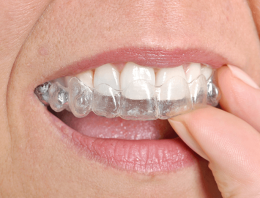Everything You Need to Know About Teeth Straightening in Drexel Hill