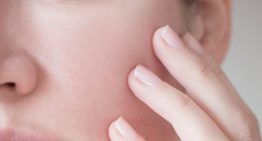 How to Reduce Pore Size: Non-Surgical Solutions in Singapore
